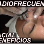 Radiofrecuencia Facial >> Antes Y Después, Precio, Críticas ..